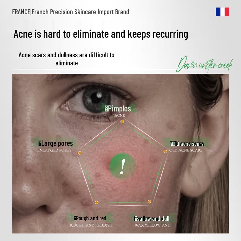 

Xixia Chenguang Whitening & Acne Repair Gel