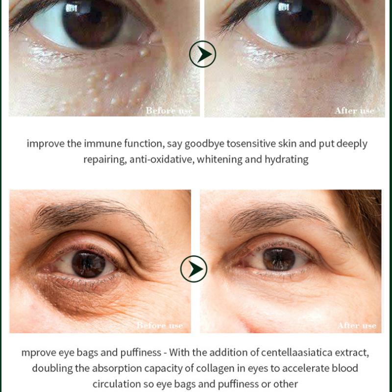 Snail Eye Cream Nourishing Dry Skin Fade Fine Lines Brighten Eye Collagen Cream Remove Dark Circles Eye Bags Skin Care Eye Bal