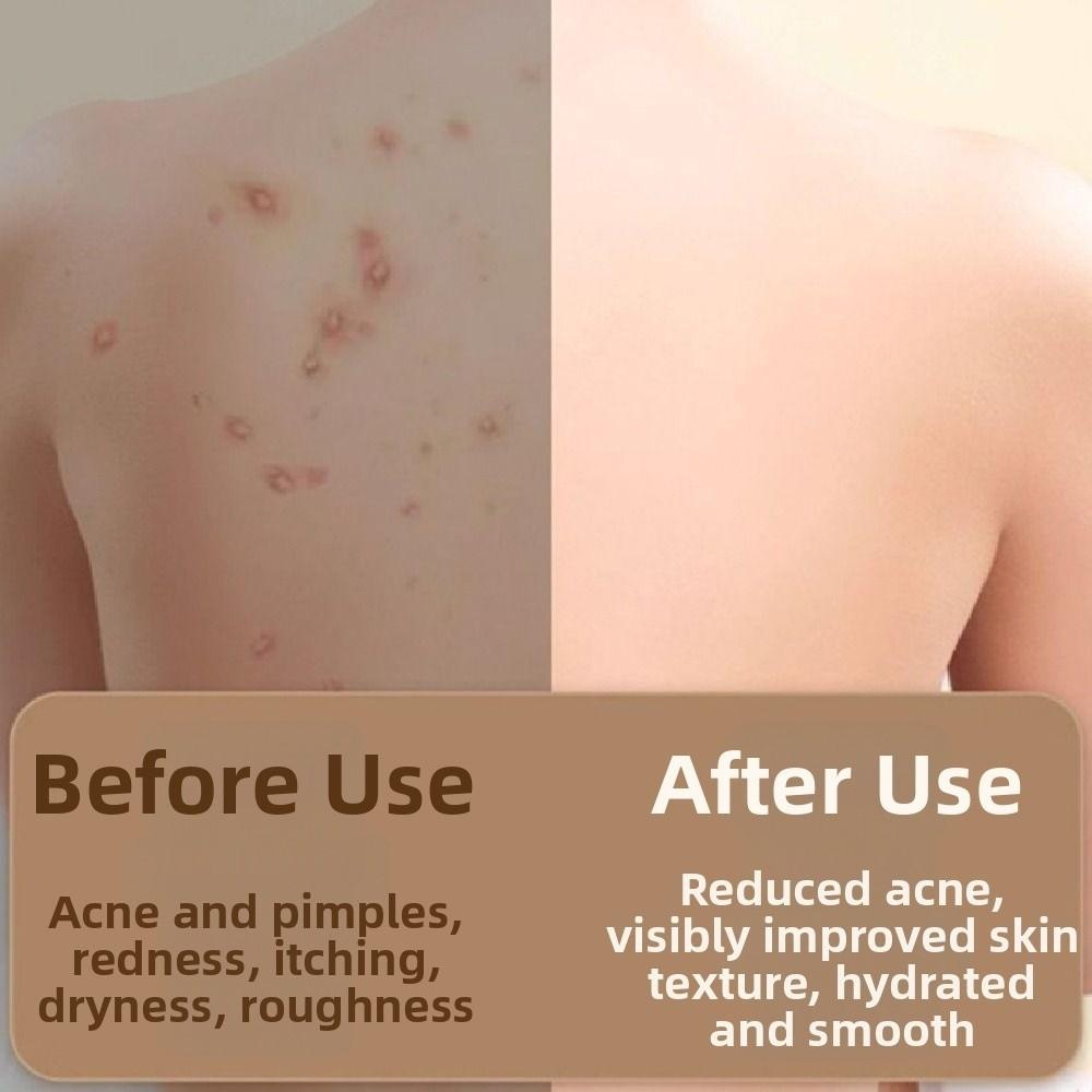 Dinosaur Shape Exfoliating Foot Pad Non-slip Shower Foot Scrubber Bath Massage Mat  Bathroom