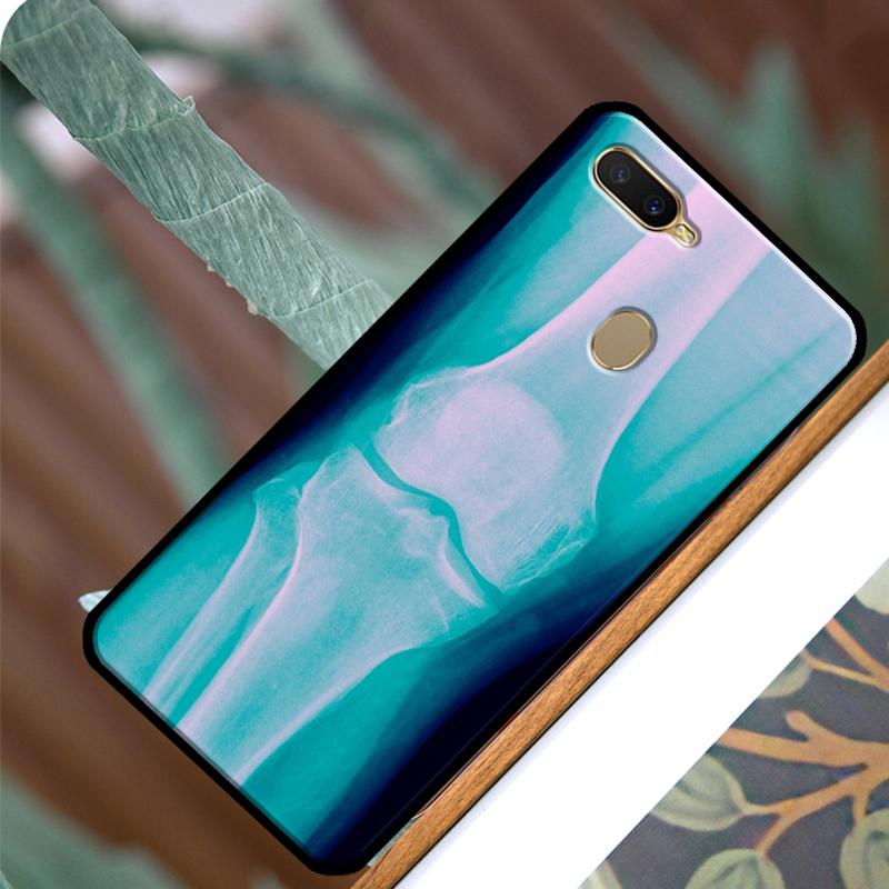 Etui na telefon z rentgenowską anatomią człowieka dla OPPO A15 A3S A5S A52 A72 A54 A74 A94 A83 A91 A93 A5 A9 A31 A53 A53S 2020