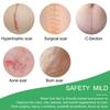 4 Sheets Scar Removal Patch Reusable Silicone Therapy Scar Repair Patch Long-lasting Sticker