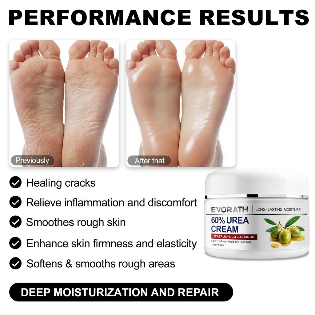 60% Urea Cream With Tea Tree Oil, Aloe Vera, And Vitamin E, Maintains Skin Hydration, For Cracked Hands And Feet, Targeting Rough, Cracked Skin-200G