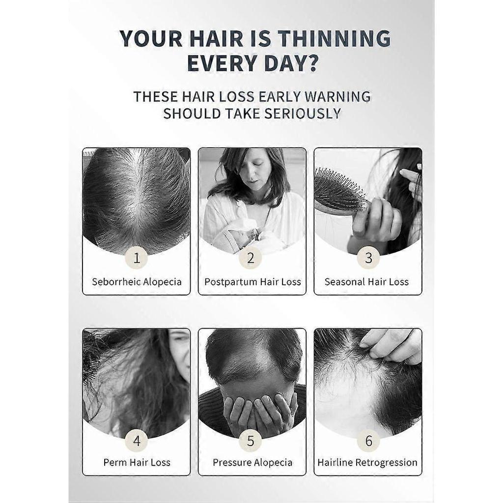 5% Hair Growth Spray, Extra Strength Hair Regrowth Treatments with Biotin 20ml