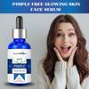 Anti Pimple Face Serum Brighten Skin Lighten Spots Hyaluronic Face Essence Skin Care, Pack 1
