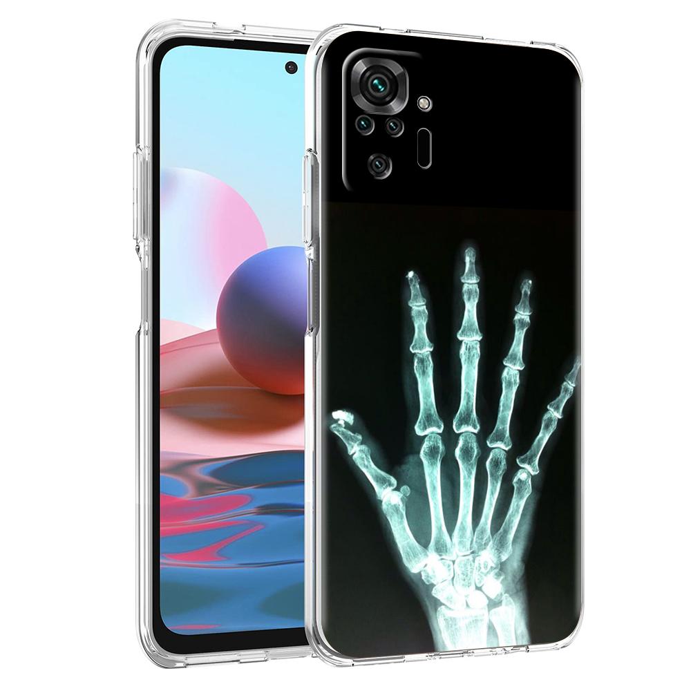 

Прозрачный чехол для телефона для Redmi 14C 13C 10C 10 9 Note 13 12 11 K50 K40 Plus Pro 4G 5G Мягкий ТПУ чехол Осень Рентген Кости Руки for Redmi 14C
