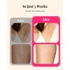 990000 Flashes Laser Hair Removal for Women and Men IPL Hair Removal Body Bikini and Facial Areas Painless Permanent HairRemoval