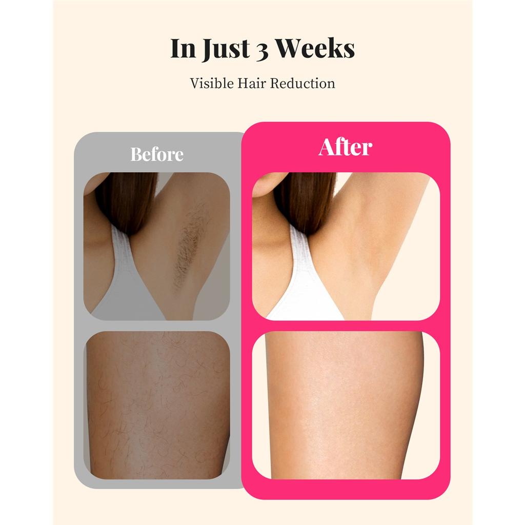 990000 Flashes Laser Hair Removal for Women and Men IPL Hair Removal Body Bikini and Facial Areas Painless Permanent HairRemoval