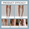 Herbal Varicose Veins Cream Relieves Swelling, Soreness And Reduces Leg Discomfort Anti-Swelling Cream