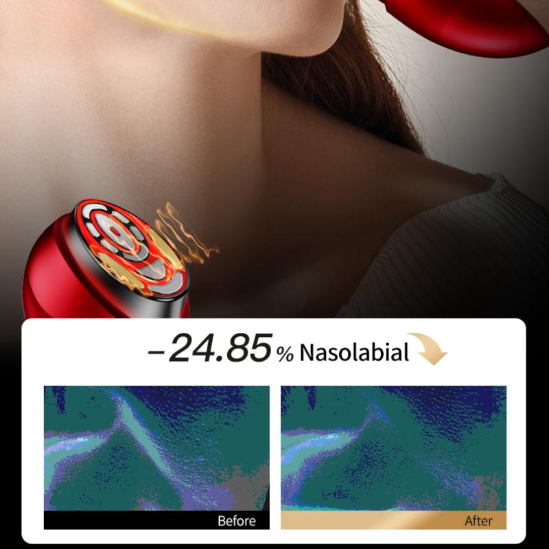 Instrument de frumusețe cu microcurent EMS Canon de colagen Instrument de îngrijire a pielii pentru uz casnic Instrument de ridicare și fermitate a ochilor