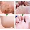 Herbal Anti Crack Foot Cream Heel Cracking Repair Products Exfoliation Dead Skin Removal Softening Moisturize Smooth Skin Care