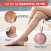 Venous Care Spray Reduces Vascular Protrusions and Smooths Out Varicose Veins the Legs and Throughout the Body.