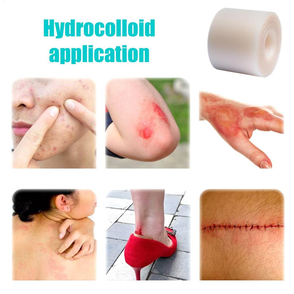 Hydrocolloid Roll For Wound Care Hydrocolloid Patch Bandages With Self-Adhesive Bed Sore Bandages Highly Absorbent For Burn