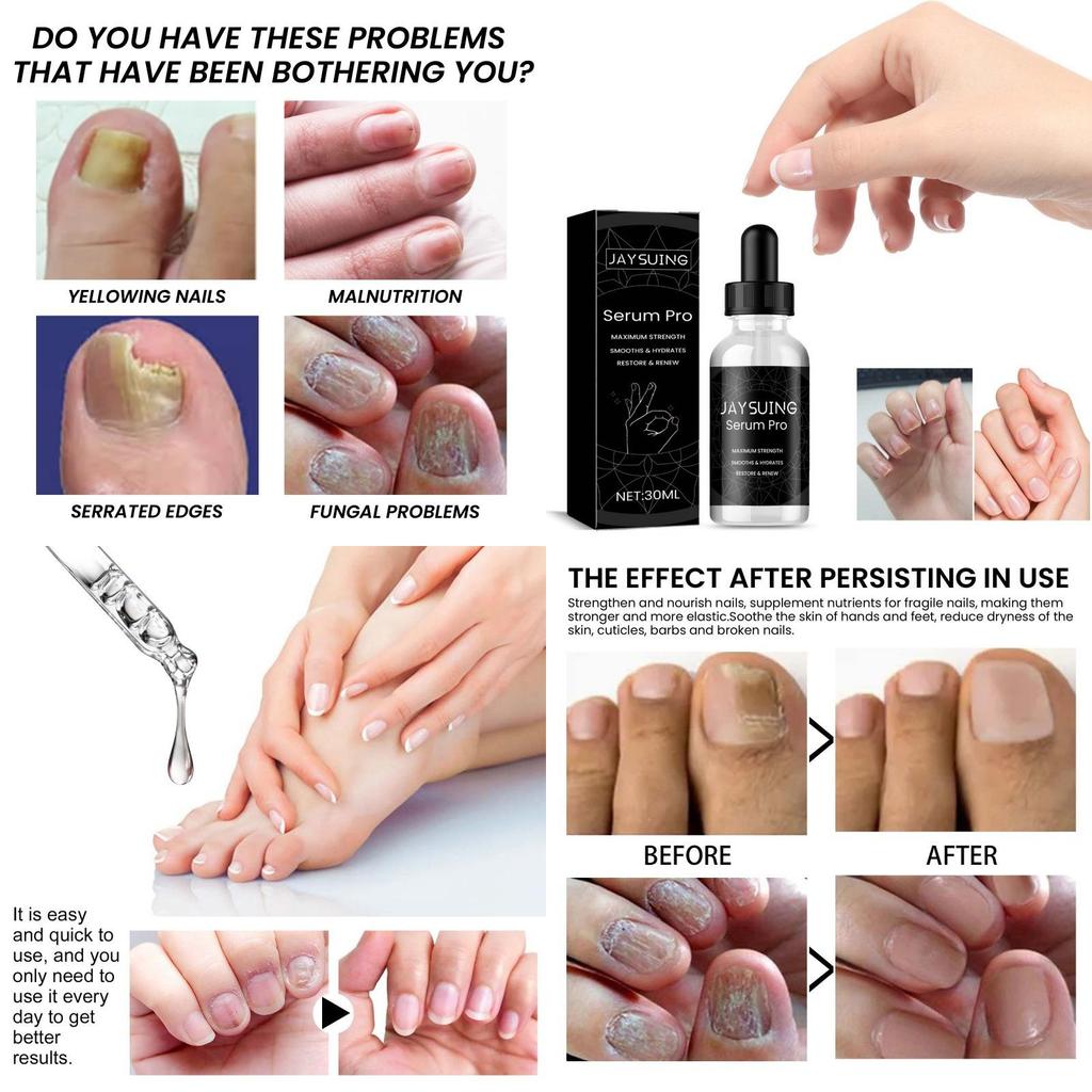 Nourishing Jaysuing Nail Repair Essence For Healthy Strong Nails 30ml