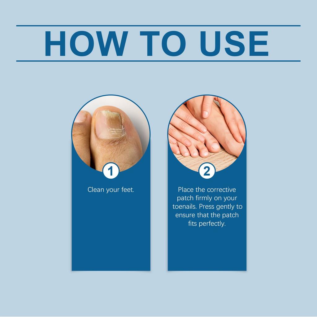 Korekční náplast na nehty na nohou Zlepšuje stav nehtů, Pomáhá při a Péči o Náplasti na nehty