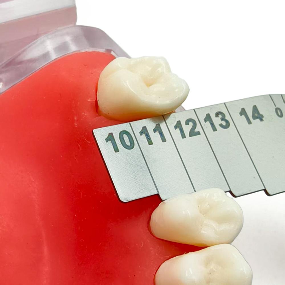 Edelstahl Dentalimplantat Platzbewertungsmessgerät Kieferorthopädisches Lisa-Messgerät zur Vorbereitung der prothetischen Rehabilitation