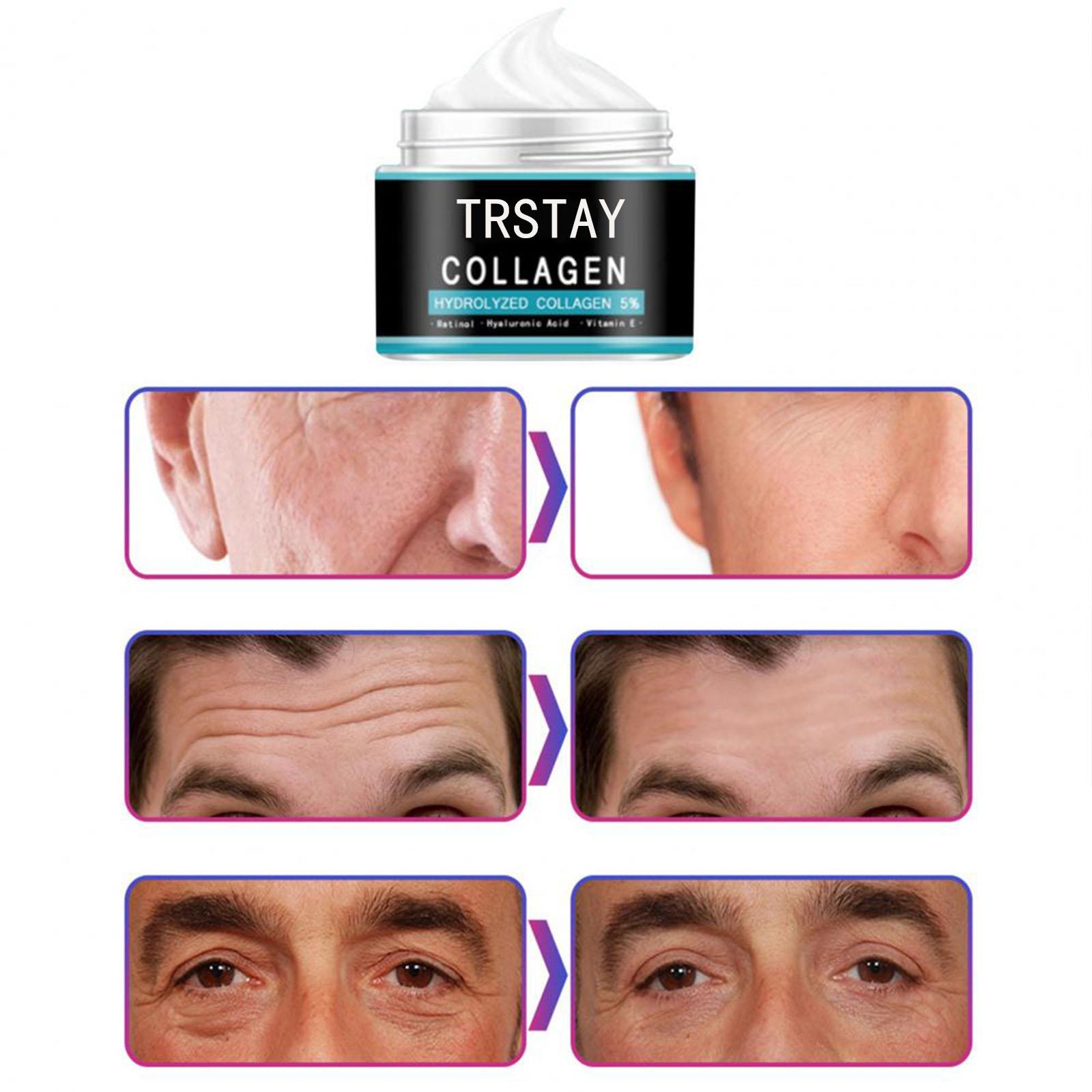 

Прочный крем против морщин Пухлый Кожа Нераздражающий Ежедневные расходные материалы Глубокие увлажняющие антивозрастные кремы Мужчины Используют