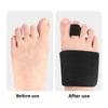 Hammer Toe Foot Guard Male and Female Toe Straightening Auxiliary Cover Claw Toe Overlapping Toe Strap Adjustment Foot Guard