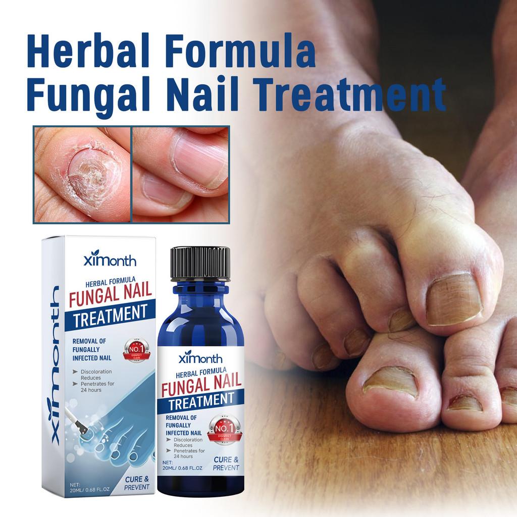 Ximonth Nährende Formel für gesunde, starke, weiche Nägel und Nagelhautpflege