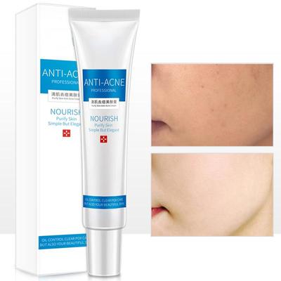 Creme de tratamento de acne hidratante controle óleo encolhendo poros remover marcas produto de remoção de espinhas