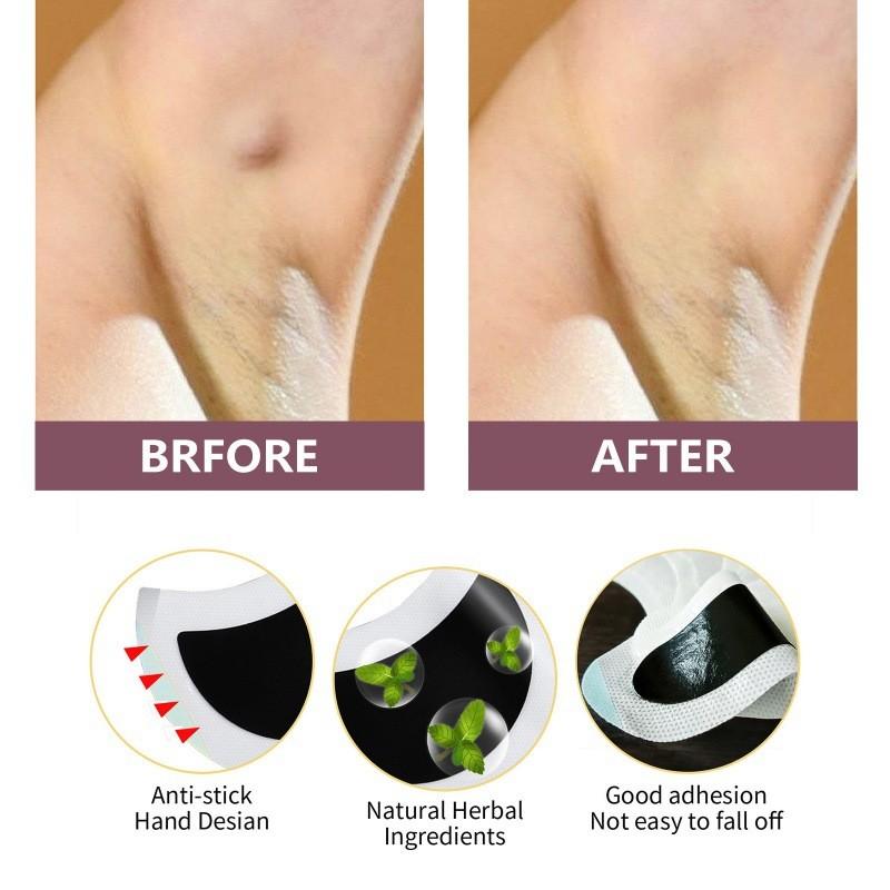 Plasturi Eelhoe pentru Îngrijirea Corpului Limfatic Alinare Confortabilă Pentru Zone Umflate ale Gâtului și Axilelor