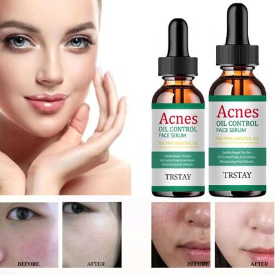 Retinol Firming Serum, Firming Lifting Essence, Softens Skin, Improves Elasticity,  Smoothes Wrinkles, Skin Care Face Serum For Women