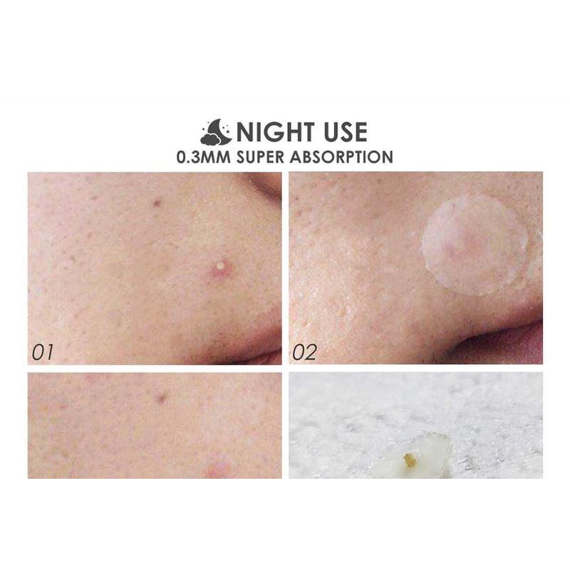 FOCALLURE - Pickelpflaster für Tag & Nacht