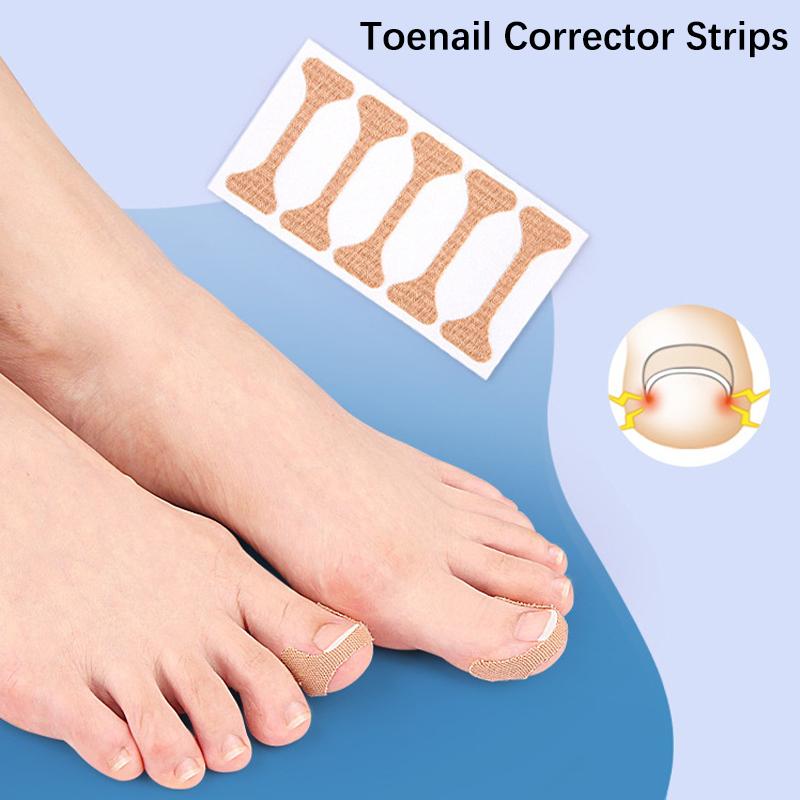 

5/15/30 Pcs Ingrown Paronychia Toenail Corrector Strips Anti Fungal Nail Correction Stickers Anti Infection Nail Treatment Patch 3 Sheet