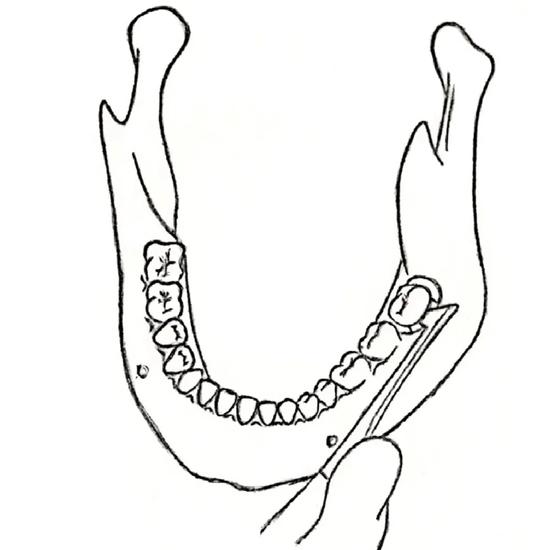 GDC Root Elevators Cryer - Left Standard (Ea30)