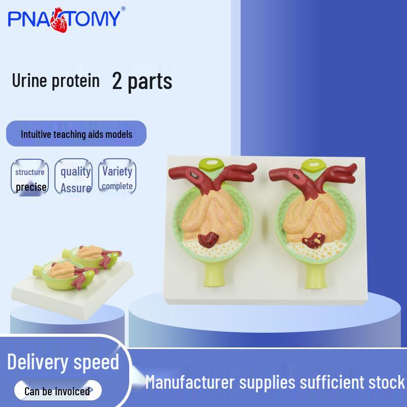 2-Part Human Anatomy Urine Protein Model for Medical Teaching 20x15x6.5