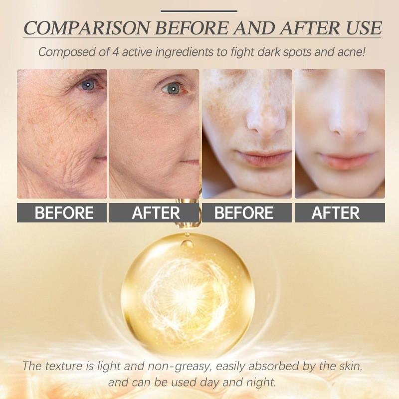 Eelhoe Retinol Collagen Cream For Smooth Radiant Skin Reduces Fine Lines And Dark Spots