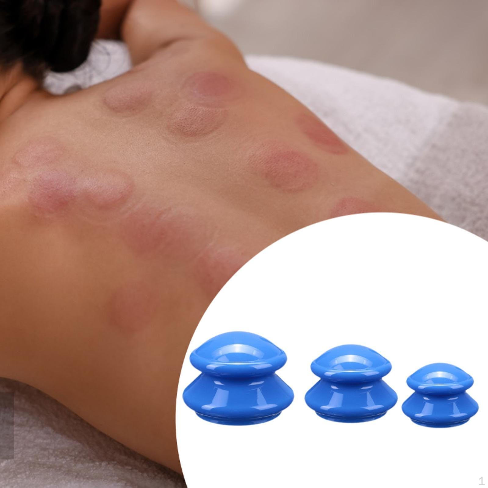 

3 шт. Антицеллюлитные массажные банки, китайские банки, профессиональный вакуумный массаж для тела и ног