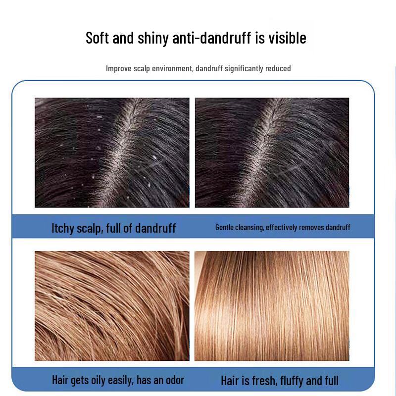 100 Years Hair Softening Anti-Dandruff Shampoo