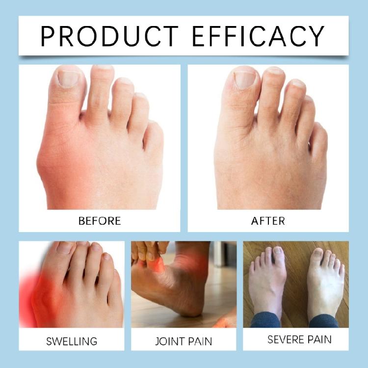 Hallux Valgus Corrector Bunions for Toes Corrector Adjustable Foot Care Bunions Corrector with Toe Separator Women Men