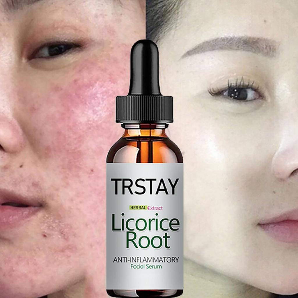 Купить Удаление черных пятен, восстановление, отбеливающая сыворотка ...