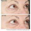 Strivectin Hyperlift Eye Instant Eye Fix For Bags  Lines   Crepiness .34 Oz