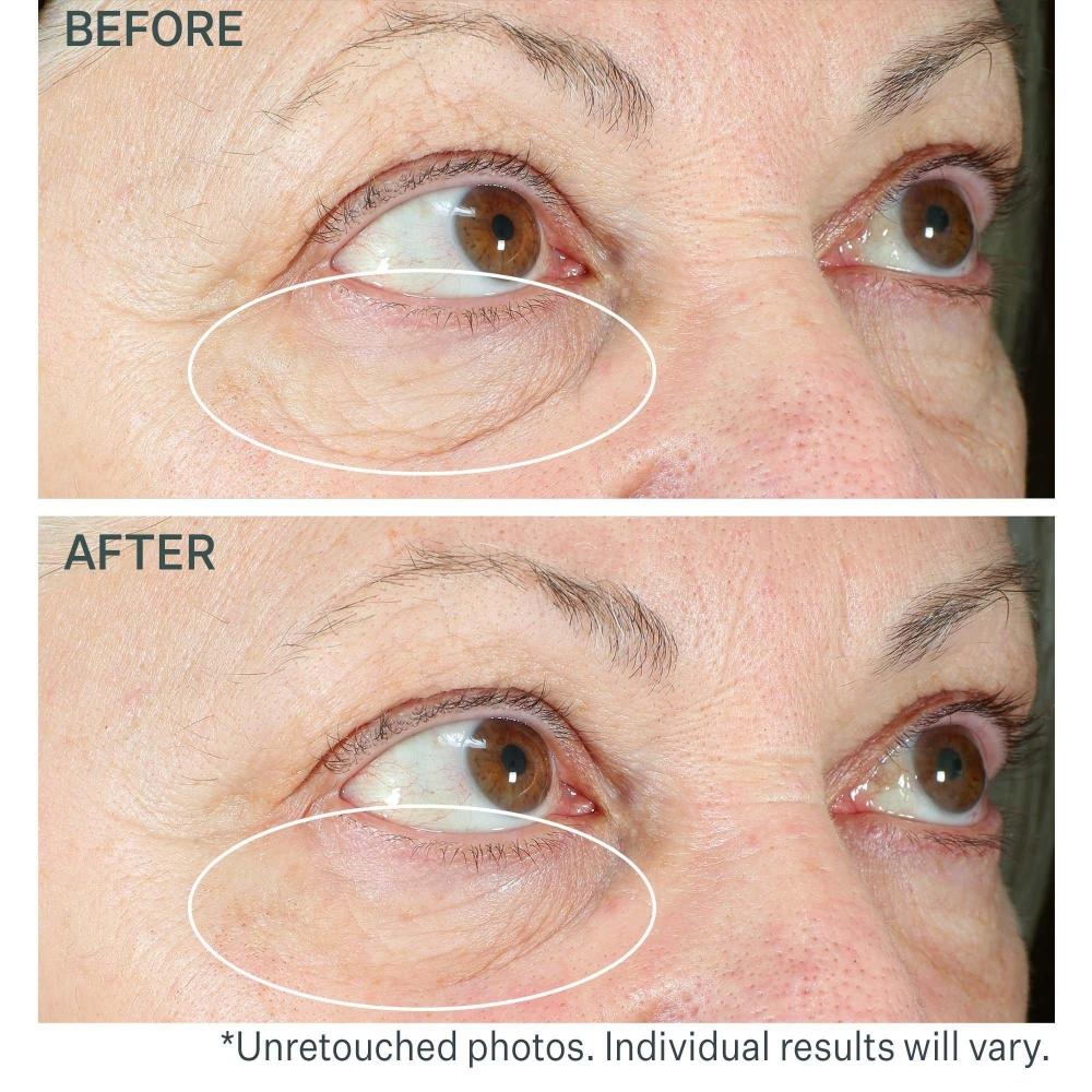 Strivectin Hyperlift Eye Instant Eye Fix For Bags  Lines   Crepiness .34 Oz