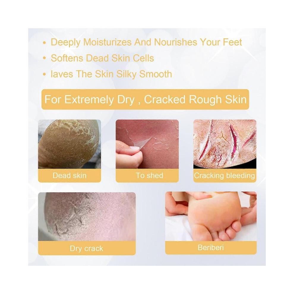 Feet Instant Foot Peeling Spray, Exfoliating Foot Mask for Summer, Hydrating & Antibacterial