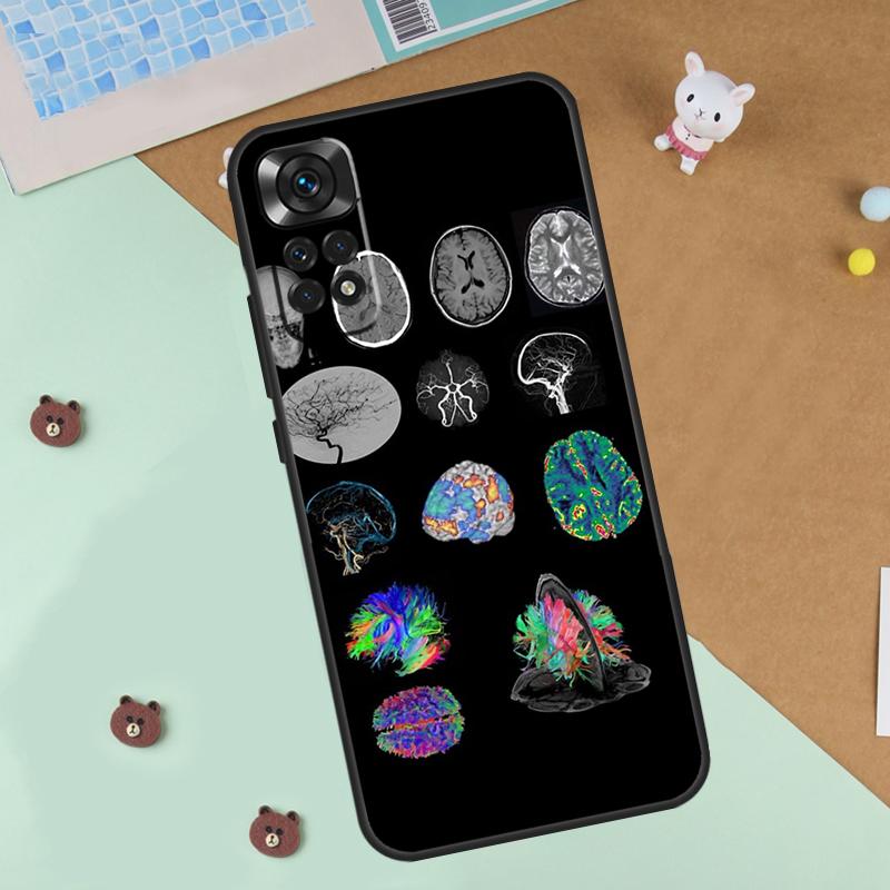 Anatomy Brain Case For Xiaomi Redmi Note 13 12 11 9 10 14 Pro 10S 11S 12S Cover For Redmi 13C 10C 12C 14C