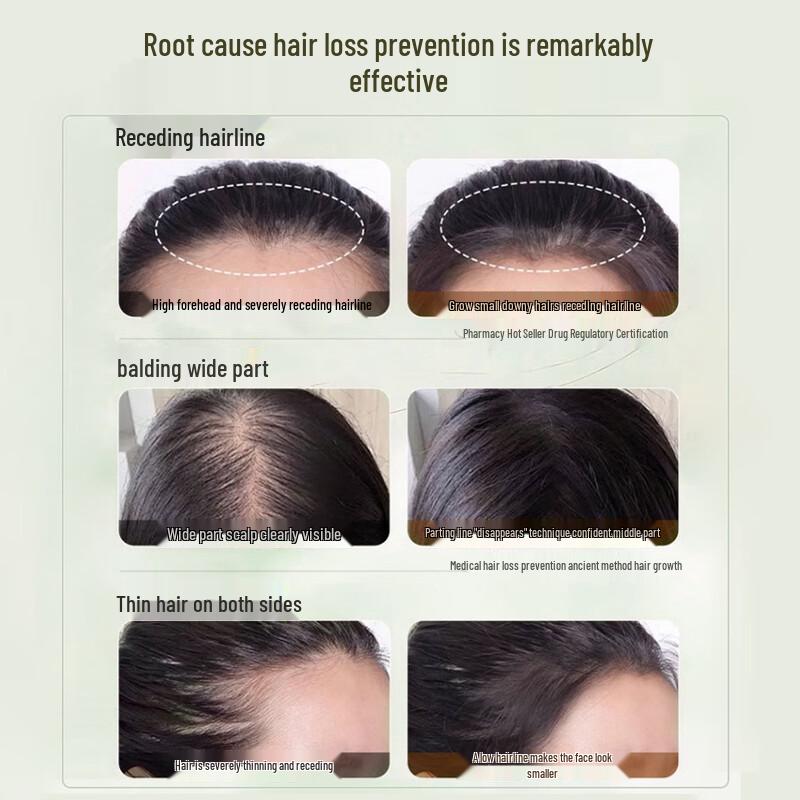 Tong Ren Tang Anti-Haarausfall & Haarwachstum Shampoo mit Ingwer