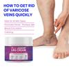 Cream Leg Swelling Relief Eliminate Vasculitis Phlebitis Improve  Spider Veins Soothing Cream