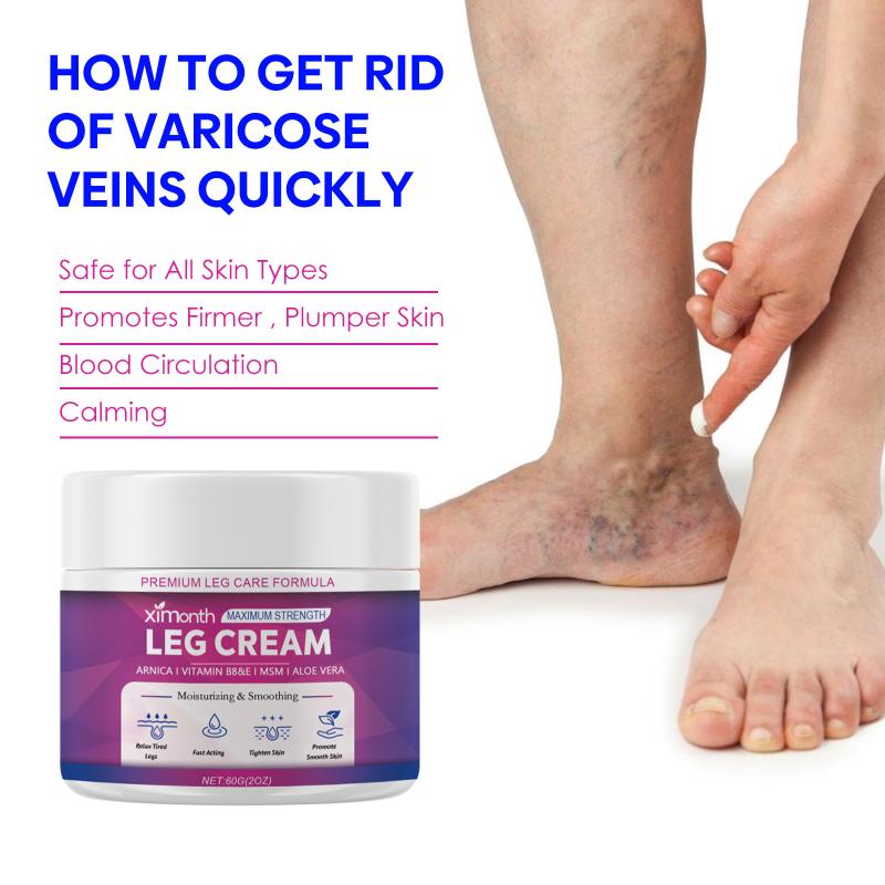 Cream Leg Swelling Relief Eliminate Vasculitis Phlebitis Improve Spider Veins Soothing Cream