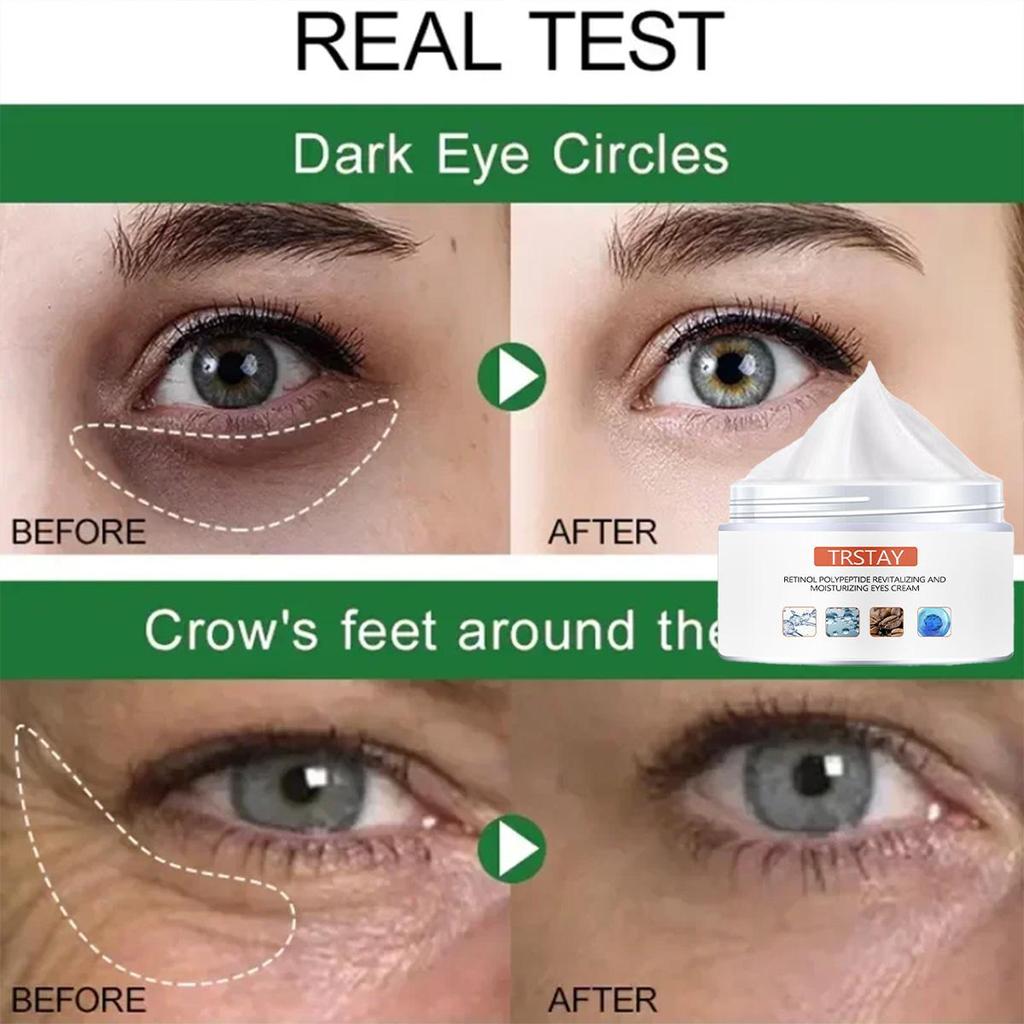 Intensive Eye Cream For Wrinkle Reduction And Deep Moisturization