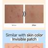 G9SKIN - Zero Solution Spot Cover Patch 108pcs