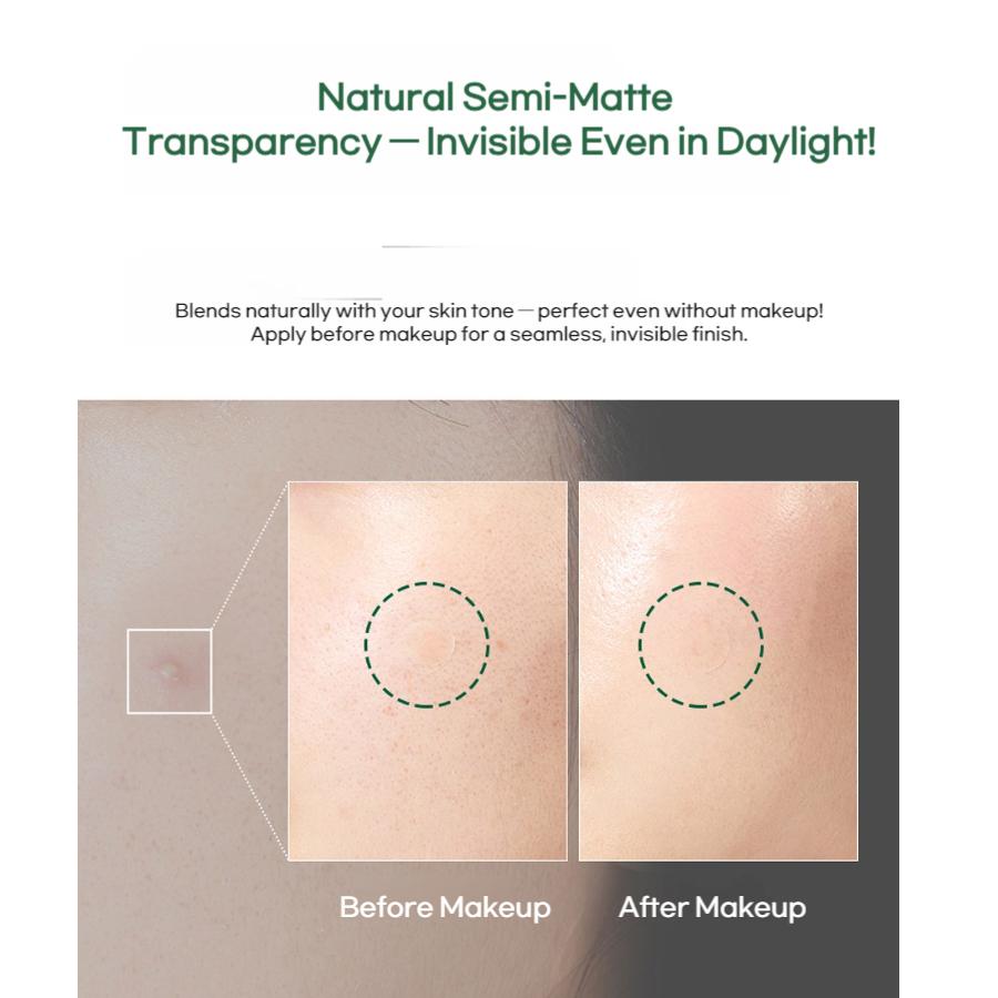 MEDI-PEEL Phyto Cicanol B5 Spot Patch S (12 Patches × 2 Packs)