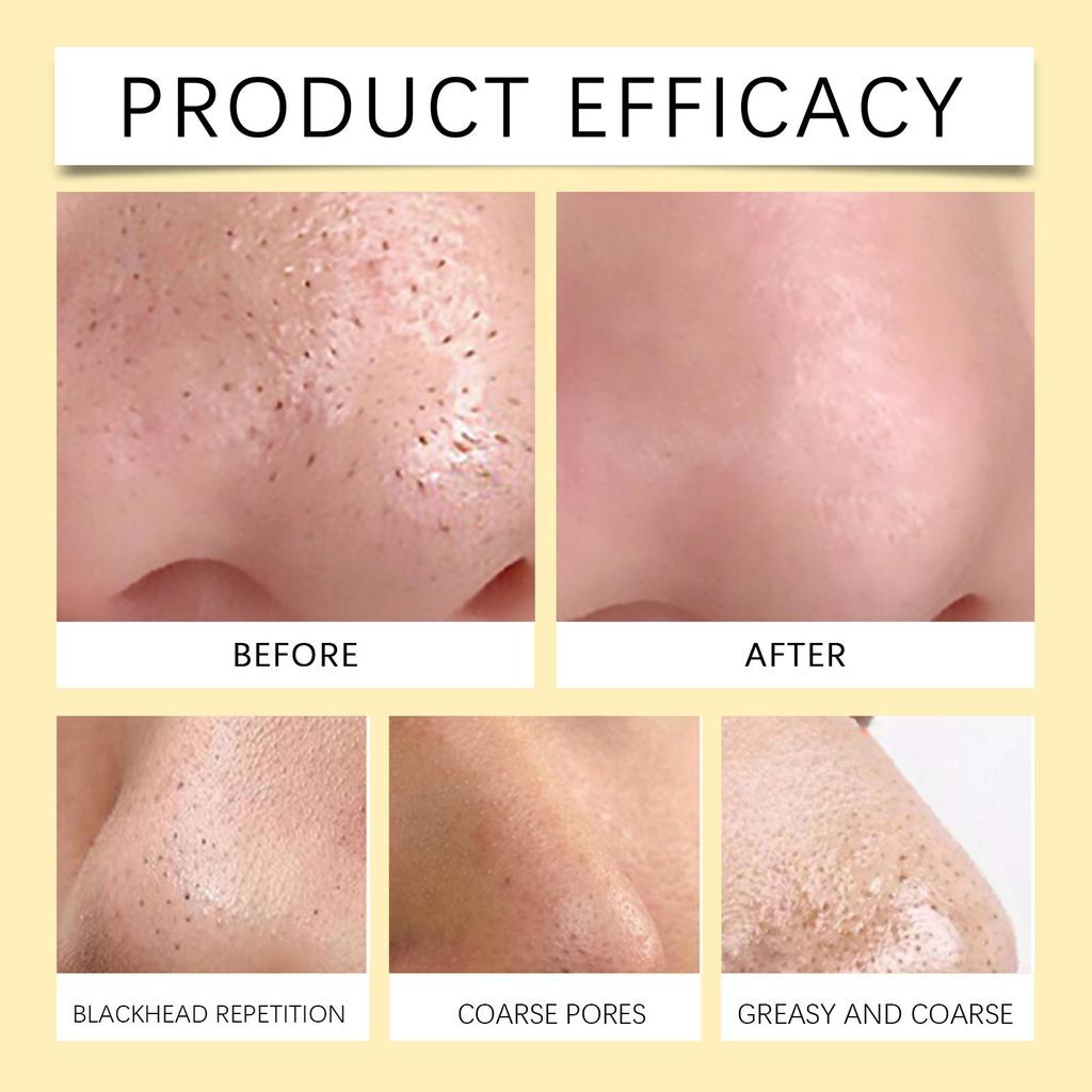 EELHOE Mitesser-Reinigungsstreifen für die Nase Sanfte Reinigung Gesicht T-Zone Poren Akne Feuchtigkeitsspendend Haut Abziehbare Nasenmaske