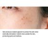 CARE:NEL - Anti-Melasma Cica Treatment Toner