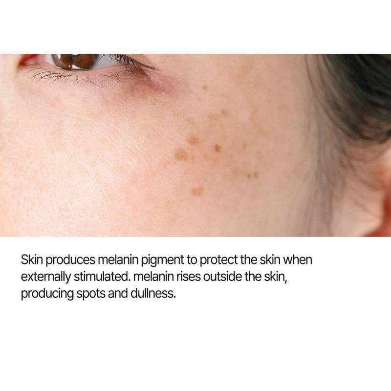 CARE:NEL - Anti-Melasma Cica Treatment Toner