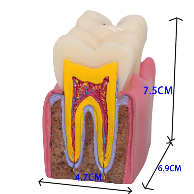 Dental Implant Teaching Model & Toothbrush Preparation Resin Mold