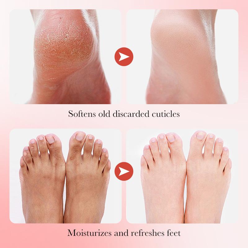 Sadoer Masque pour les pieds adoucissant et éclaircissant à la niacinamide à la fraise, traitement rajeunissant, masque pour les pieds