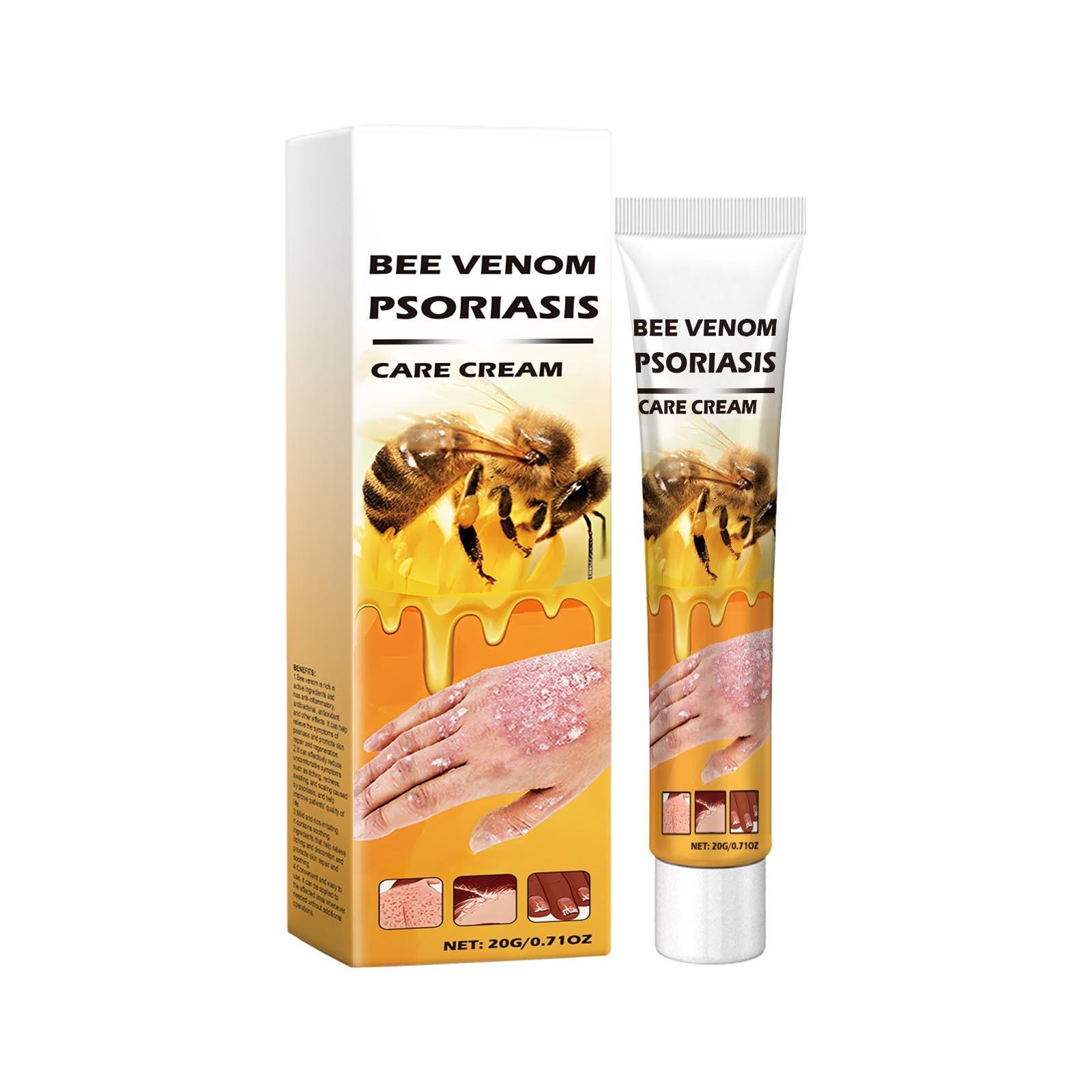 External Use Of To Tinea Manus And Feet,  And Relief Itching Care